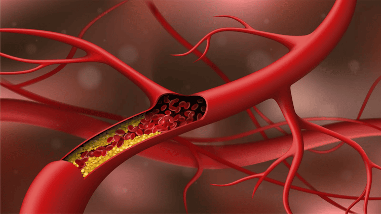 What Is Cholesterol And How To Manage Your Cholesterol Levels?